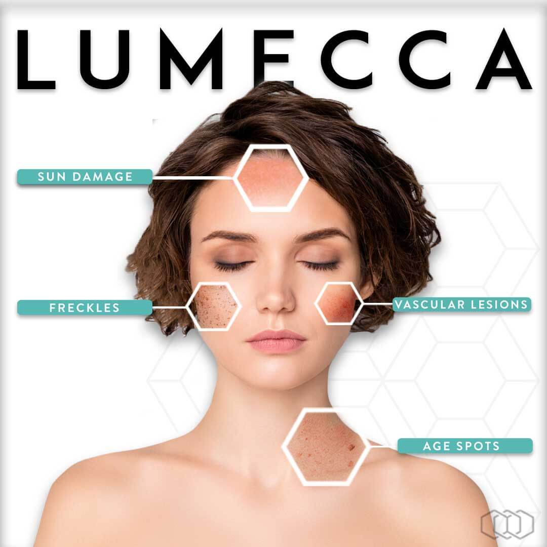 lumecca infographic instagram post brown hair preview | LJ Aesthetics Medicine | St. Petersburg, Florida, United States