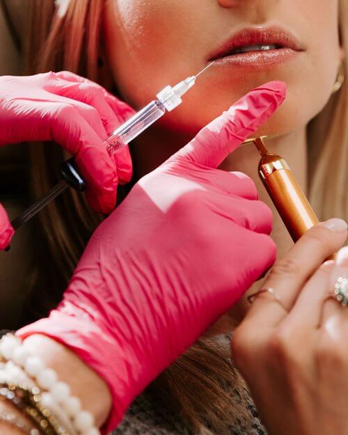 Woman Getting Lip Filler Injection | LJ Aesthetics Medicine in St. Petersburg, FL